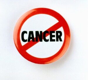 limonene cancer anticarcinogenic